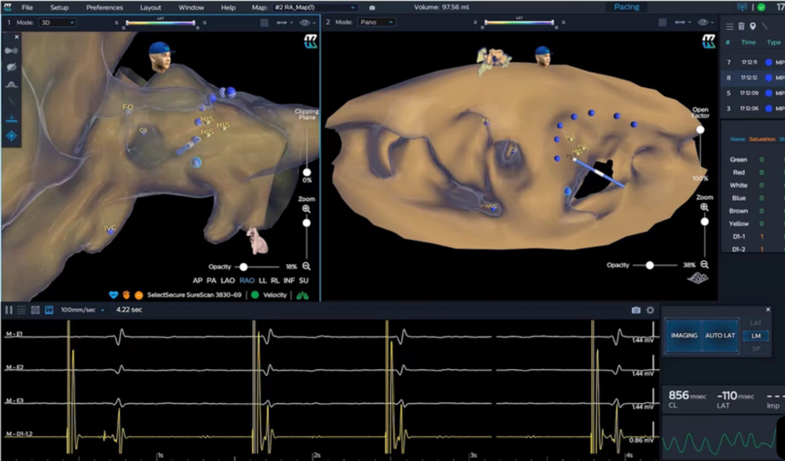 מסך CODEX EPD מניסיון קודם בפיתוח ב־Philips